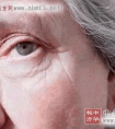 什么是老年性白内障 老年性白内障的原因、症状
