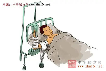 中医接骨方