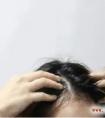 治头发出油（头发油腻）偏方！