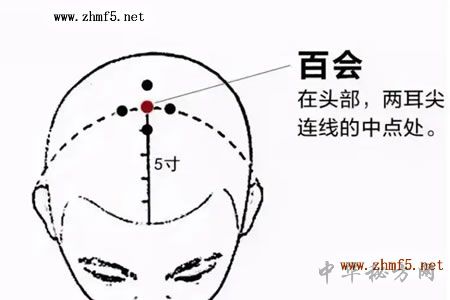 百会穴位的准确位置图
