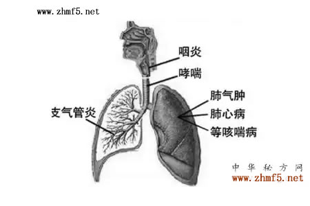 支气管炎
