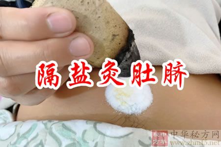 盐灸肚脐治痢疾省钱效果好
