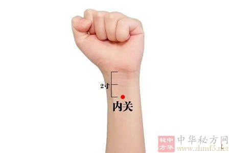 治疗心绞痛的穴位：内关穴