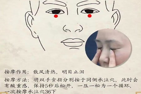承泣穴怎么按摩