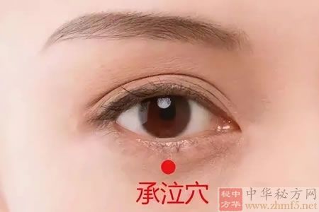 承泣穴