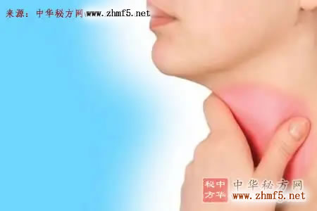 咽炎