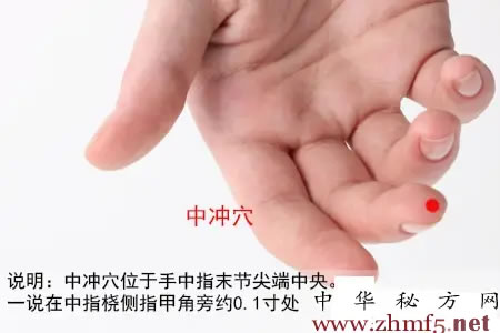 中冲穴
