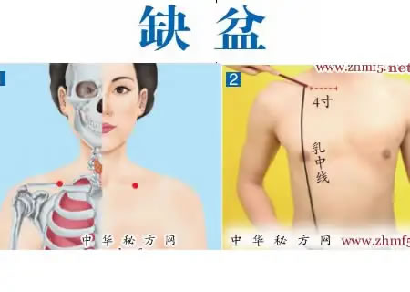 缺盆穴的取穴方法