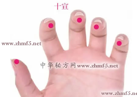十宣穴位位置图