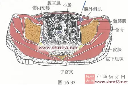 子宫穴位针灸图